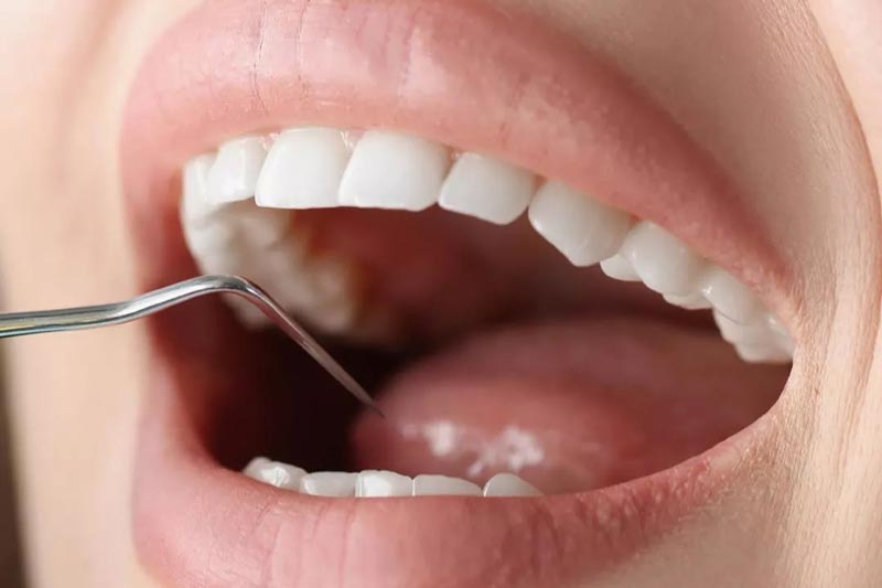 چرا بیمه تکمیلی ملت را انتخاب کنیم؟ مزایای آن چیست؟