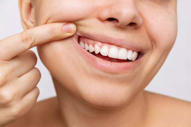 مزایا و معایب کامپوزیت دندان چیست؟