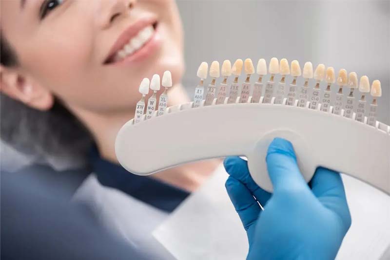 لمینت دندان یا کامپوزیت دندان؟