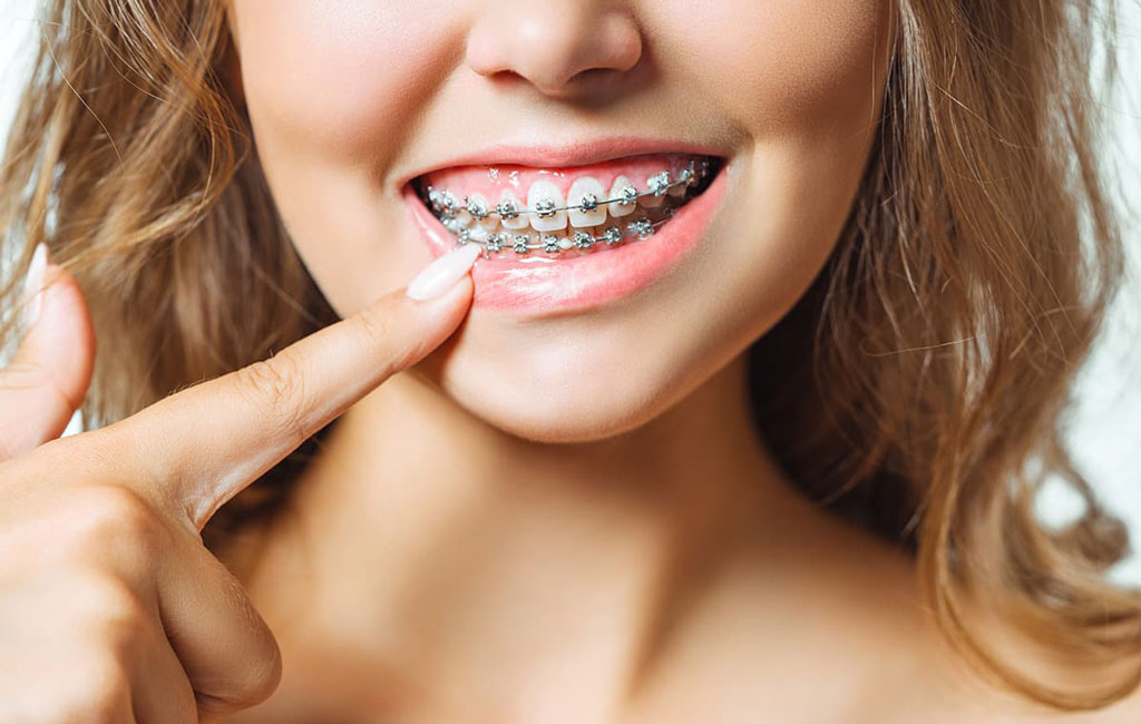 دلایل ایجاد ناهنجاری دندان و فک