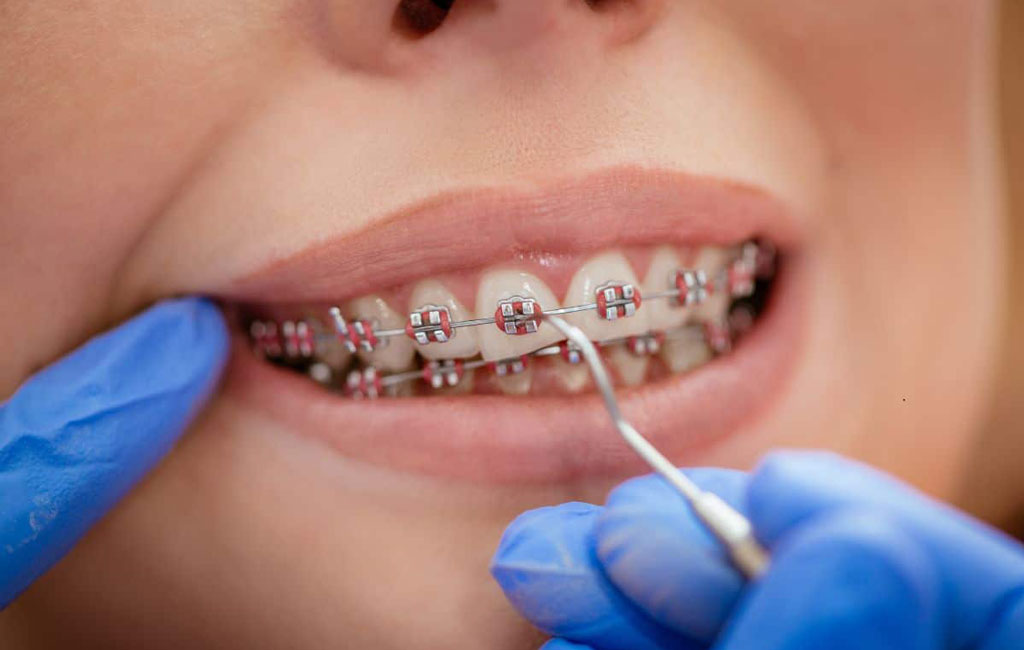 چگونه بهترین مرکز را انتخاب کنیم؟