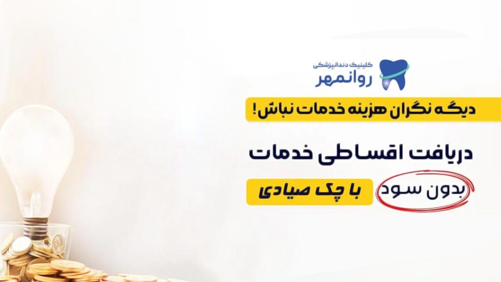 ایمپلنت دندان اقساطی