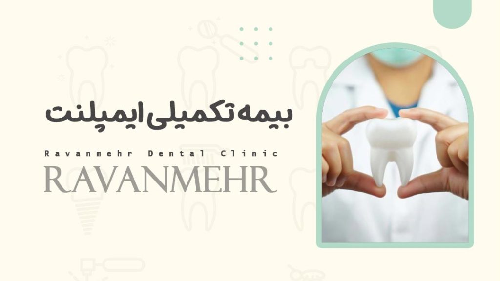 بیمه تکمیلی ایمپلنت